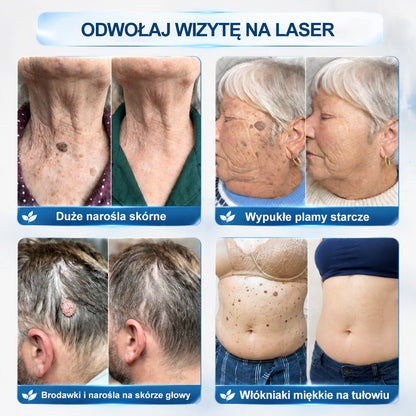 𝐏i𝐜𝐝o®💚💚7 𝑫𝒏𝒊 𝑷𝒓𝒆𝒑𝒂𝒓𝒂𝒕 𝑫𝒐 𝑼𝒔𝒖𝒘𝒂𝒏𝒊𝒂 𝑾łó𝒌𝒏𝒊𝒂𝒌ó𝒘 𝑴𝒊ę𝒌𝒌𝒊𝒄𝒉 𝑰 𝑷𝒓𝒛𝒆𝒃𝒂𝒓𝒘𝒊𝒆ń(𝐁𝐞𝐳 𝐁ó𝐥𝐮, 𝐁𝐞𝐳 𝐁𝐥𝐢𝐳𝐧 – 𝐑𝐨𝐥𝐥-𝐨𝐧)
