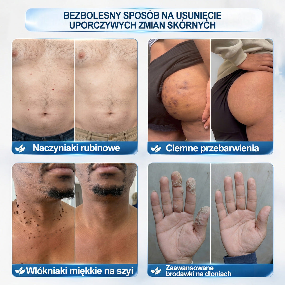 𝐏i𝐜𝐝o®💚💚7 𝑫𝒏𝒊 𝑷𝒓𝒆𝒑𝒂𝒓𝒂𝒕 𝑫𝒐 𝑼𝒔𝒖𝒘𝒂𝒏𝒊𝒂 𝑾łó𝒌𝒏𝒊𝒂𝒌ó𝒘 𝑴𝒊ę𝒌𝒌𝒊𝒄𝒉 𝑰 𝑷𝒓𝒛𝒆𝒃𝒂𝒓𝒘𝒊𝒆ń(𝐁𝐞𝐳 𝐁ó𝐥𝐮, 𝐁𝐞𝐳 𝐁𝐥𝐢𝐳𝐧 – 𝐑𝐨𝐥𝐥-𝐨𝐧)