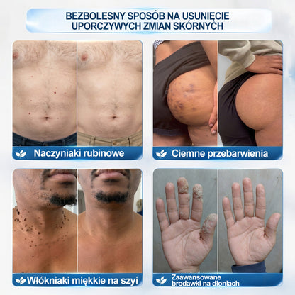 𝐏i𝐜𝐝o®💚💚7 𝑫𝒏𝒊 𝑷𝒓𝒆𝒑𝒂𝒓𝒂𝒕 𝑫𝒐 𝑼𝒔𝒖𝒘𝒂𝒏𝒊𝒂 𝑾łó𝒌𝒏𝒊𝒂𝒌ó𝒘 𝑴𝒊ę𝒌𝒌𝒊𝒄𝒉 𝑰 𝑷𝒓𝒛𝒆𝒃𝒂𝒓𝒘𝒊𝒆ń(𝐁𝐞𝐳 𝐁ó𝐥𝐮, 𝐁𝐞𝐳 𝐁𝐥𝐢𝐳𝐧 – 𝐑𝐨𝐥𝐥-𝐨𝐧)