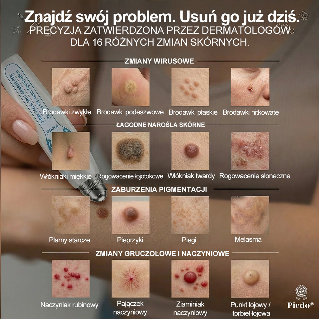𝐏i𝐜𝐝o®💚💚7 𝑫𝒏𝒊 𝑷𝒓𝒆𝒑𝒂𝒓𝒂𝒕 𝑫𝒐 𝑼𝒔𝒖𝒘𝒂𝒏𝒊𝒂 𝑾łó𝒌𝒏𝒊𝒂𝒌ó𝒘 𝑴𝒊ę𝒌𝒌𝒊𝒄𝒉 𝑰 𝑷𝒓𝒛𝒆𝒃𝒂𝒓𝒘𝒊𝒆ń(𝐁𝐞𝐳 𝐁ó𝐥𝐮, 𝐁𝐞𝐳 𝐁𝐥𝐢𝐳𝐧 – 𝐑𝐨𝐥𝐥-𝐨𝐧)